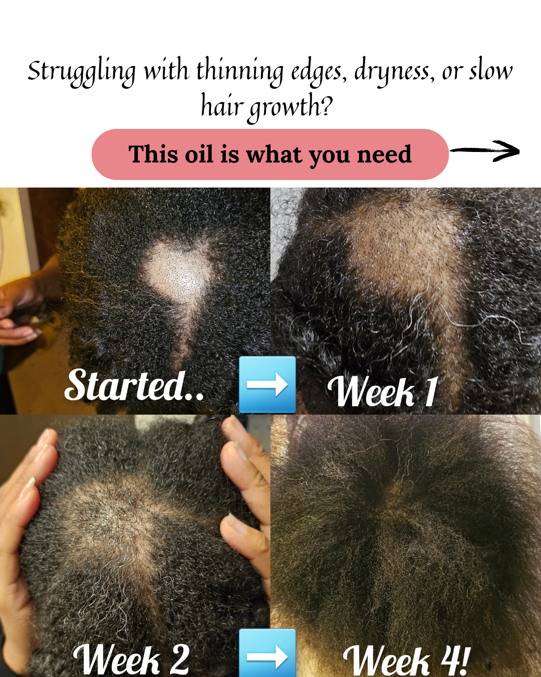 Nourishing Growth Rosemary Hair Oil | Strengthen, Hydrate & Promote Healthy Hair 4oz