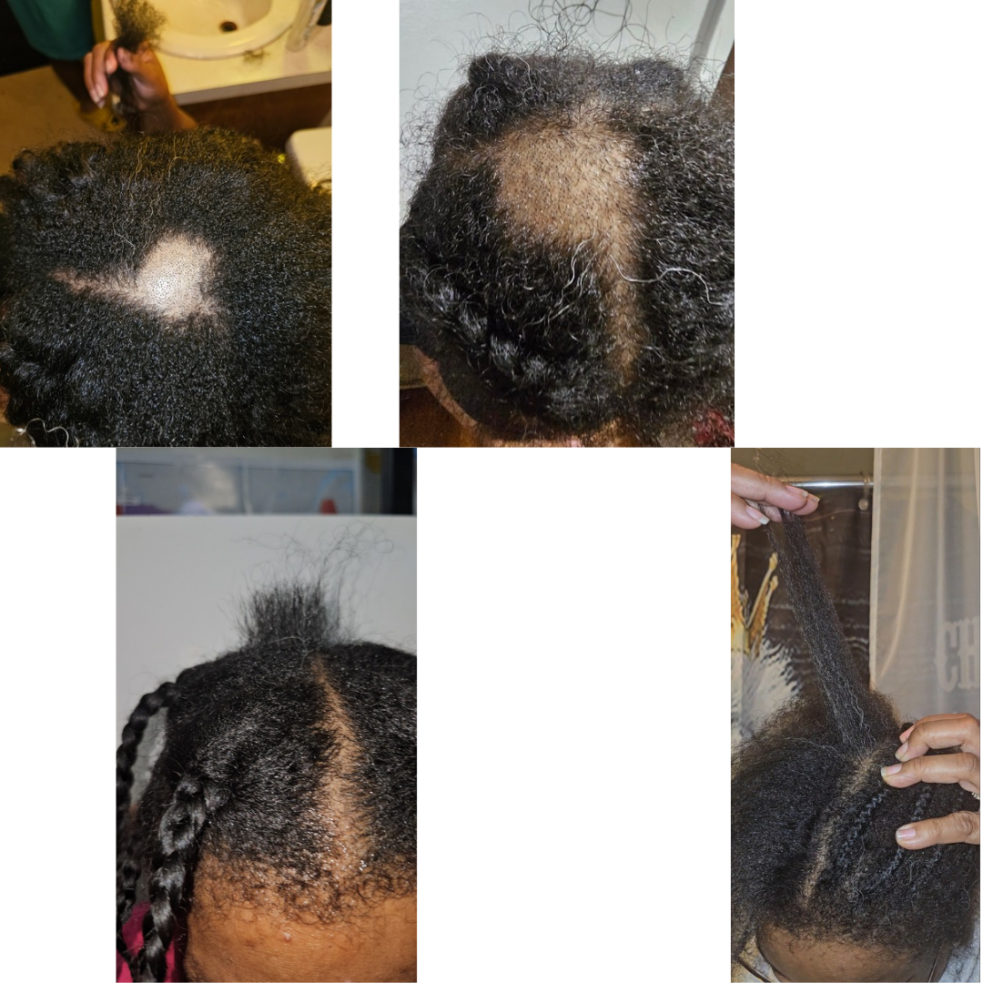 Nourishing Growth Rosemary Hair Oil | Strengthen, Hydrate & Promote Healthy Hair 4oz
